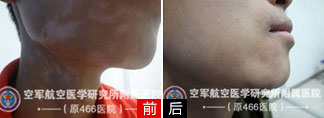 沿7